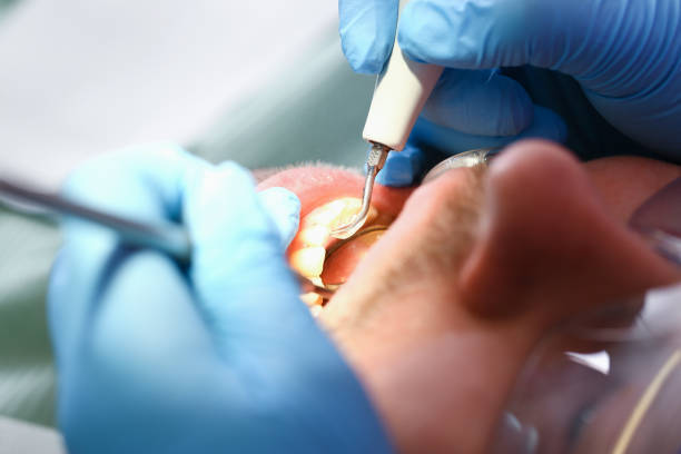 Best Pediatric Emergency Dentist in Robins Af, GA