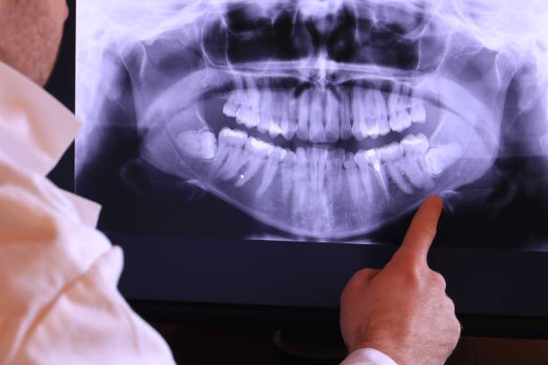 Best Emergency Dental Care for Abscessed Tooth in Robins Af, GA