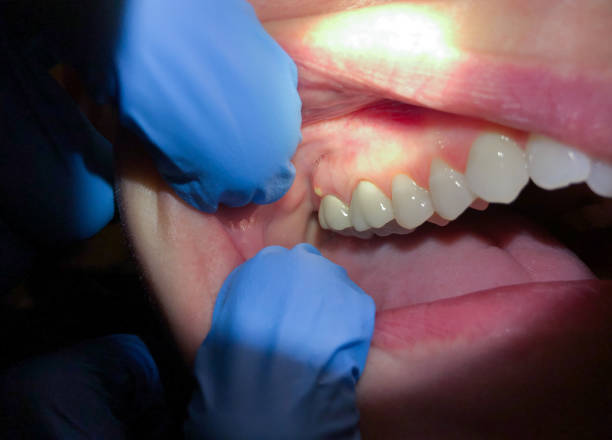  Robins Af, GA Emergency Dentist Pros