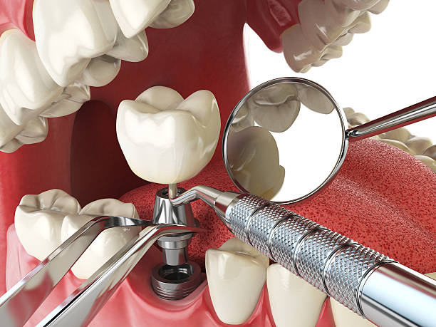 Best Mobile Emergency Dentist in Robins Af, GA